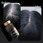 ROOTONIX Korean Hair Growth Supplement – Herbal Black Bean & Hasuo Complex